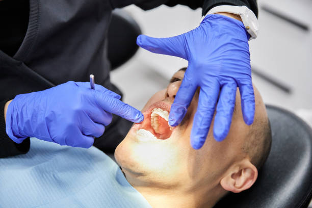 Best Emergency Root Canal Treatment in Rock Falls, IL